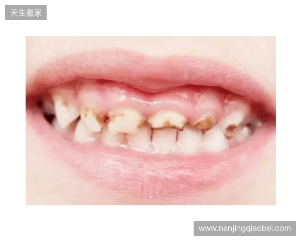 韦林顿确诊上唇部贯通伤;11、21牙半脱位;上颌前牙区牙槽骨骨折 韦林顿确诊上唇部贯通伤;11、21牙半脱位;上颌前牙区牙槽骨骨折